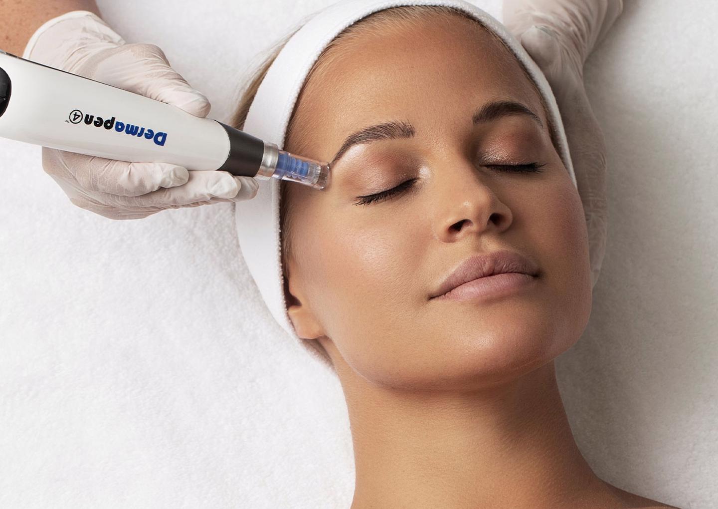 Microneedling